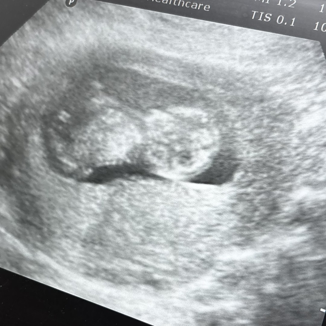 Photo shared by Reyna for their Babylist baby registry.