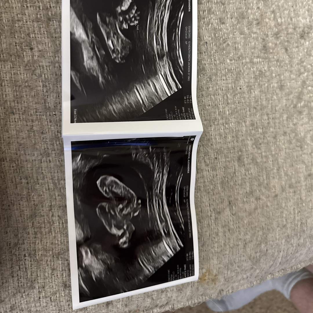 Photo shared by Alexandria for their Babylist baby registry.