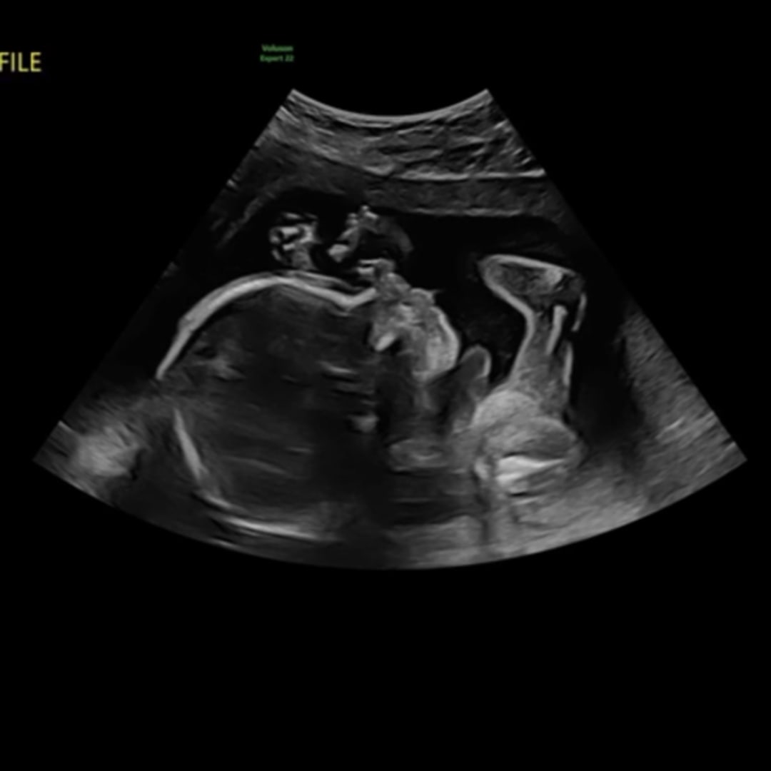 Photo shared by Aaliyah for their Babylist baby registry.