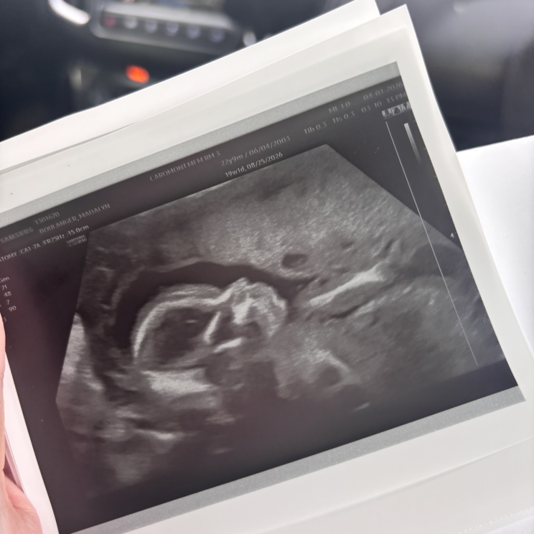 Photo shared by Madalyn for their Babylist baby registry.