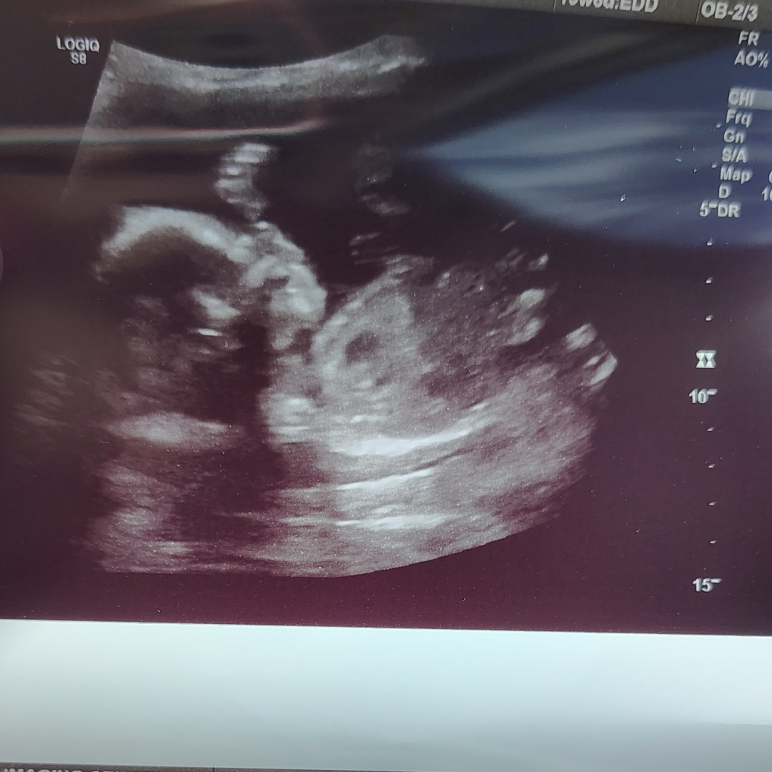 Photo shared by Haley for their Babylist baby registry.