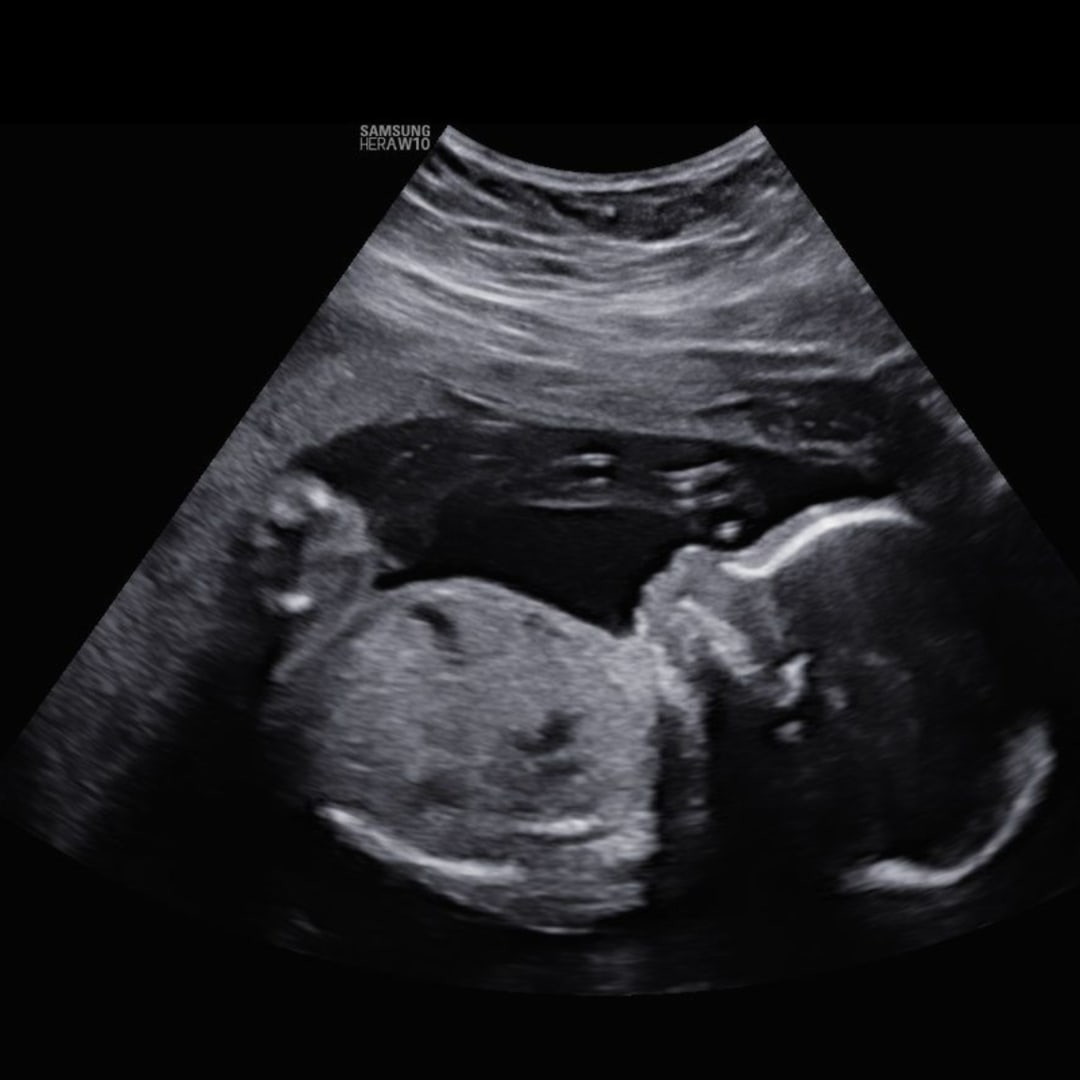Photo shared by Giselle for their Babylist baby registry.