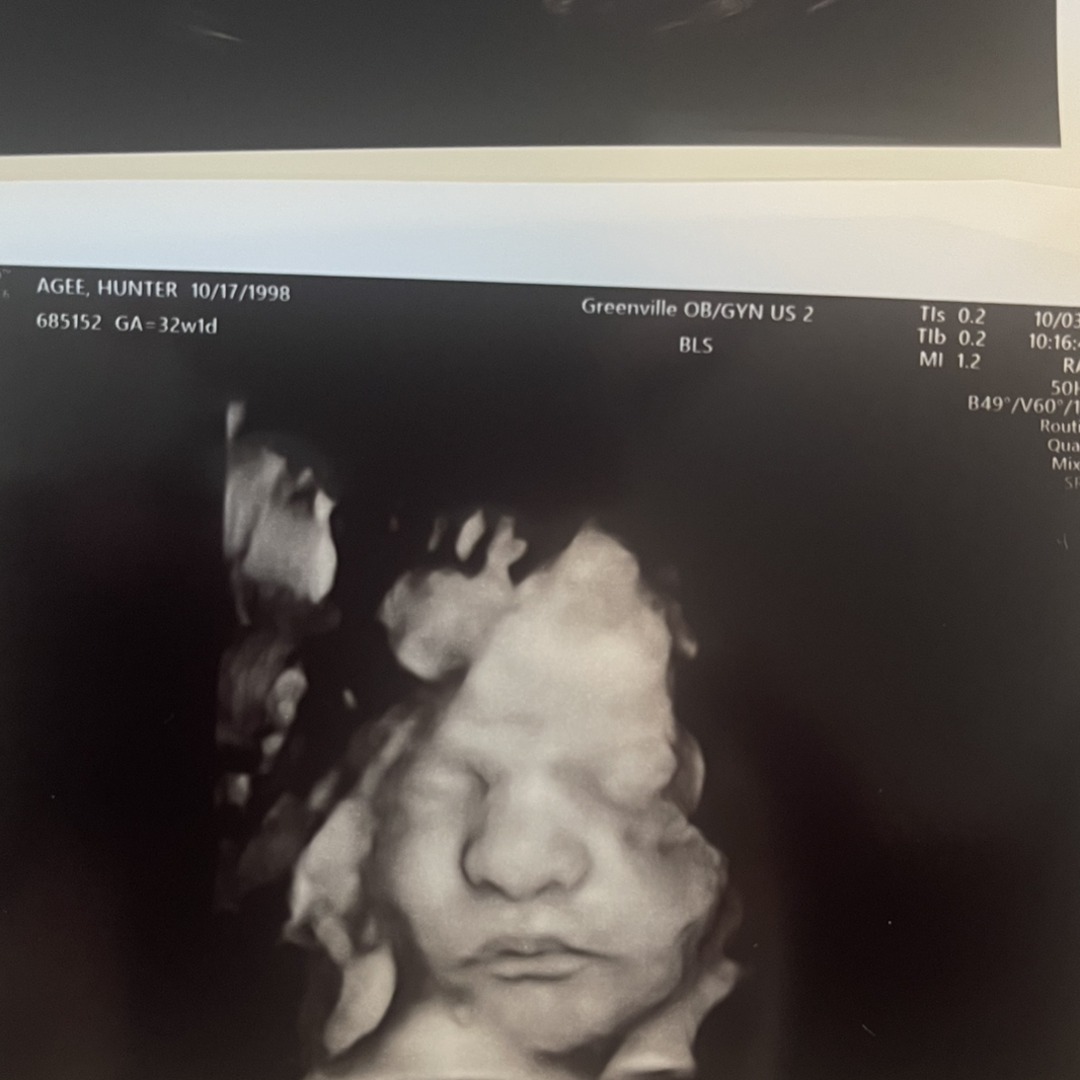 Photo shared by Hunter Kate for their Babylist baby registry.