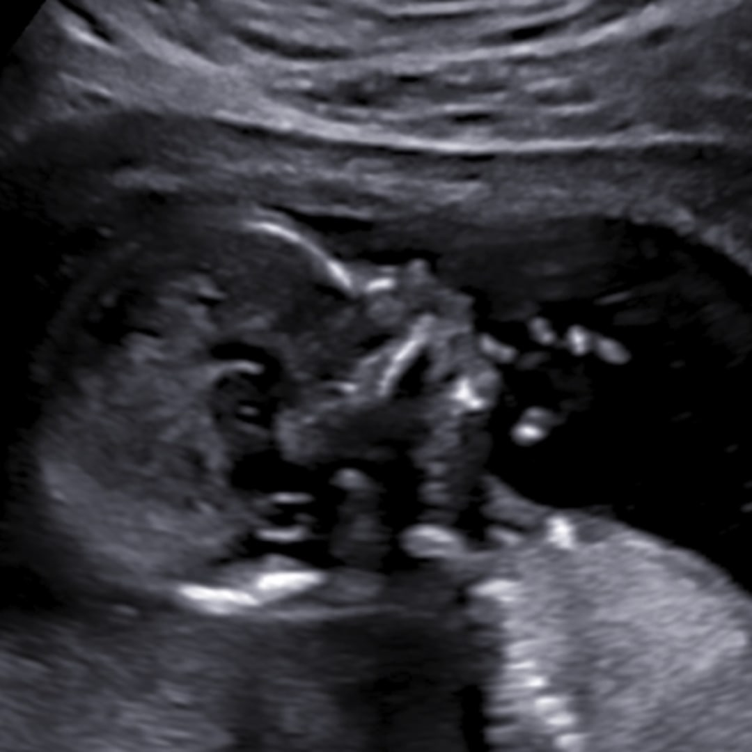 Photo shared by Lyric for their Babylist baby registry.