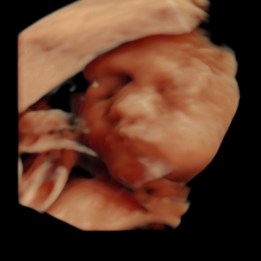 Photo shared by Victoria for their Babylist baby registry.