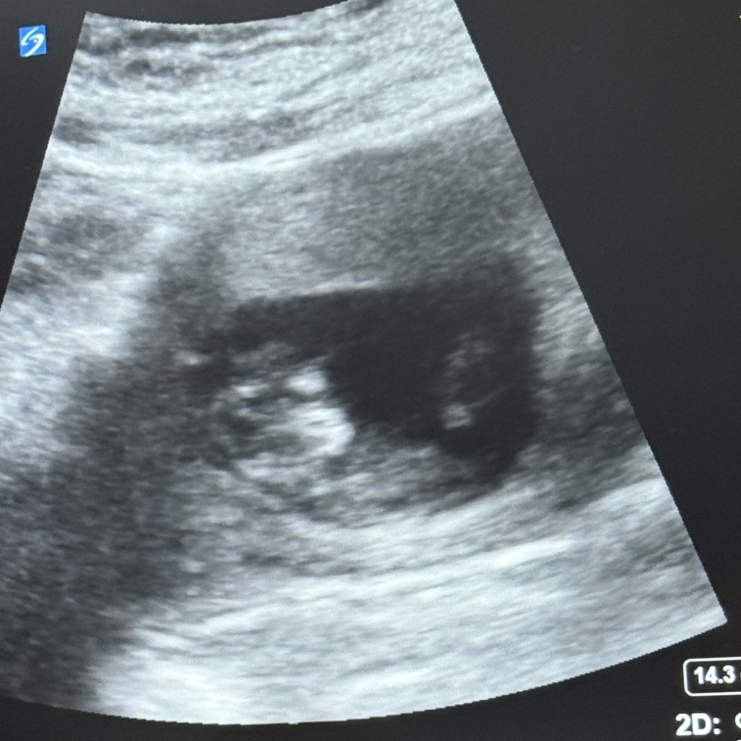 Photo shared by Elizabeth for their Babylist baby registry.