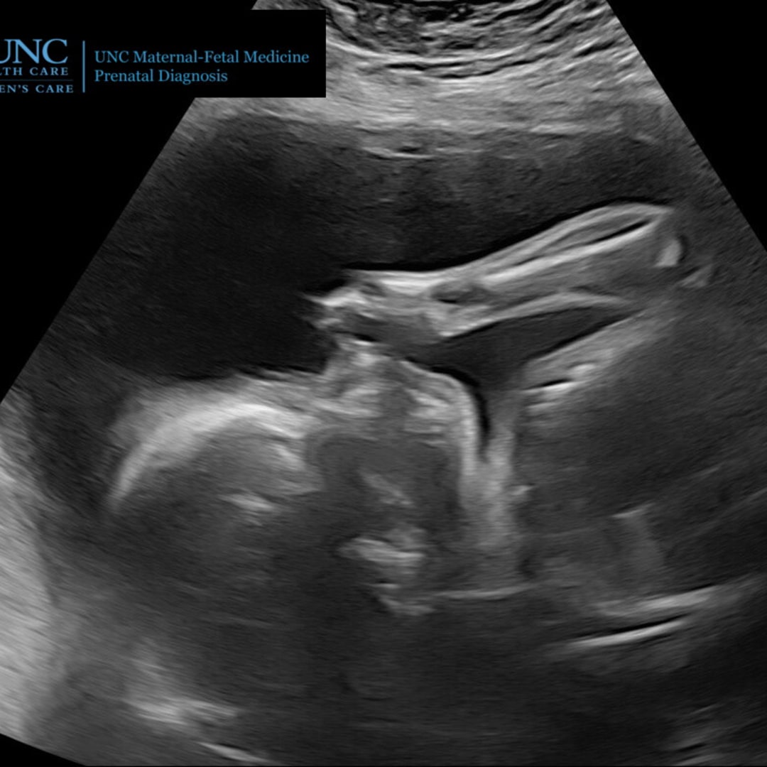 Photo shared by Lydia for their Babylist baby registry.