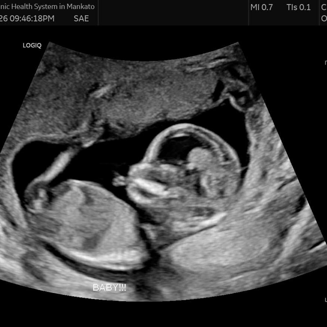Photo shared by Izzie for their Babylist baby registry.