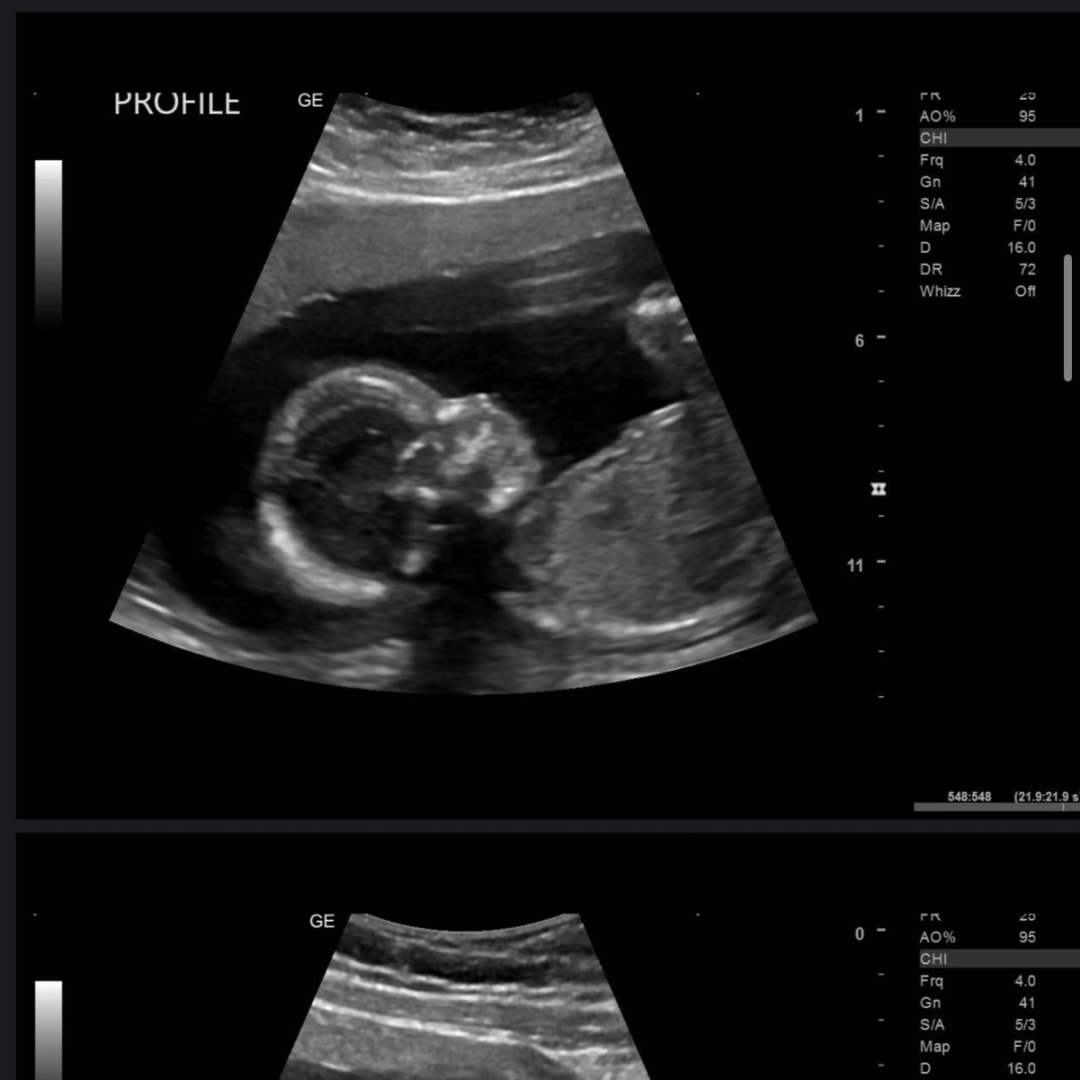 Photo shared by Alexis for their Babylist baby registry.