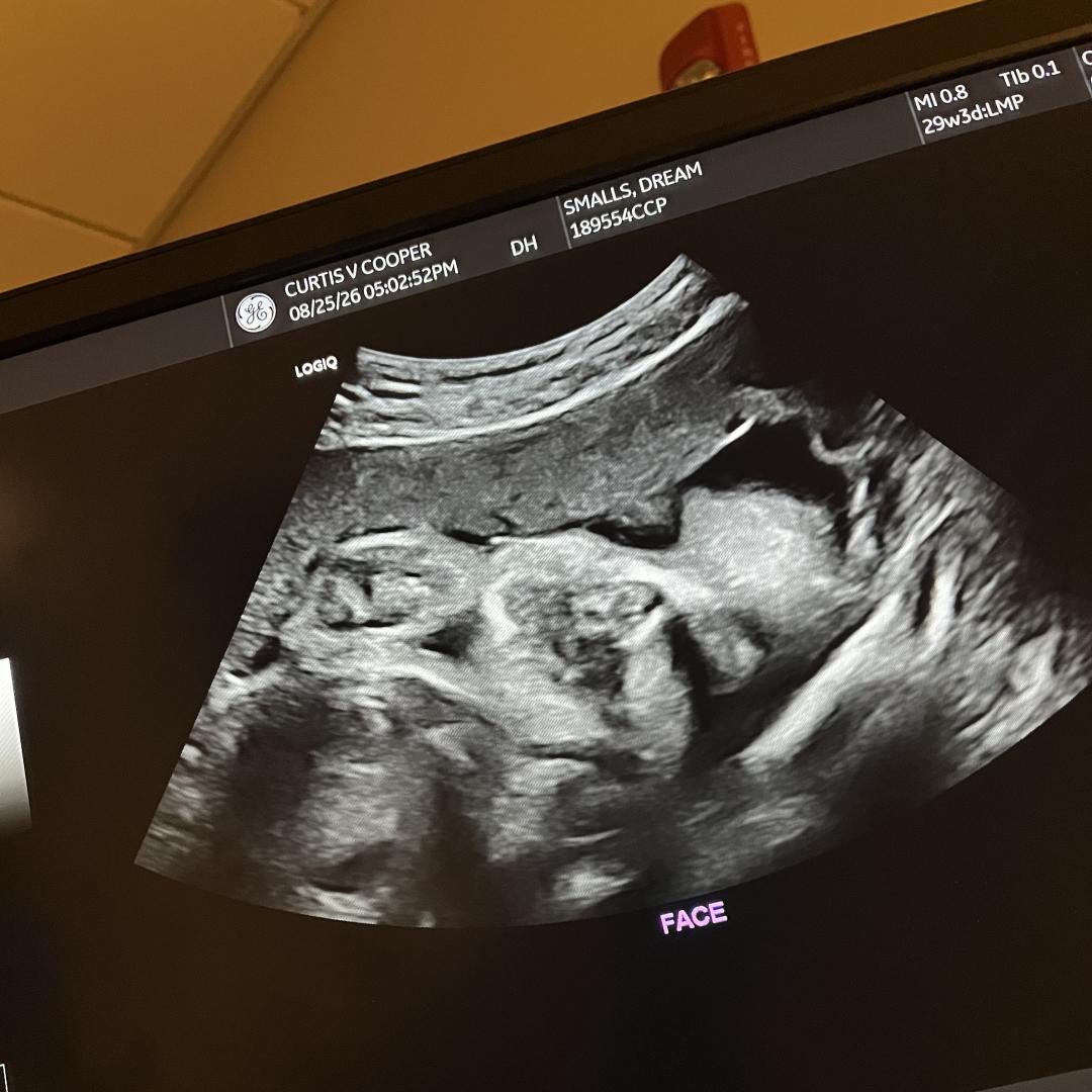 Photo shared by Dream for their Babylist baby registry.