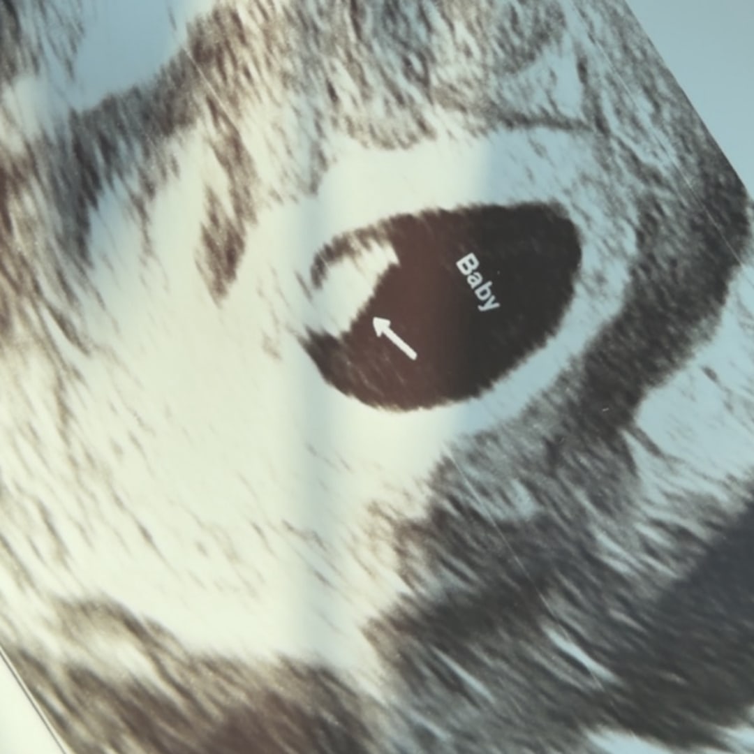 Photo shared by Elisabeth for their Babylist baby registry.