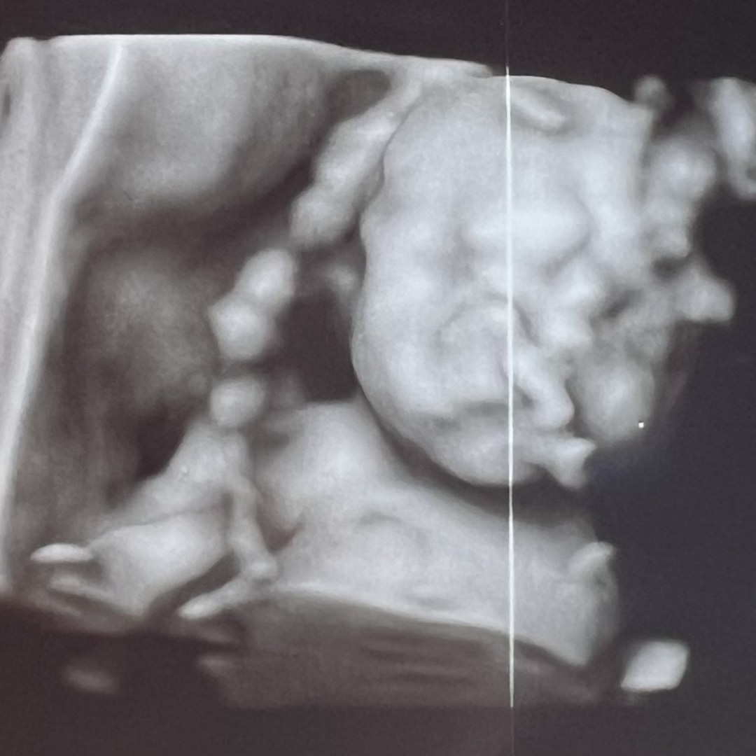 Photo shared by Brittney for their Babylist baby registry.