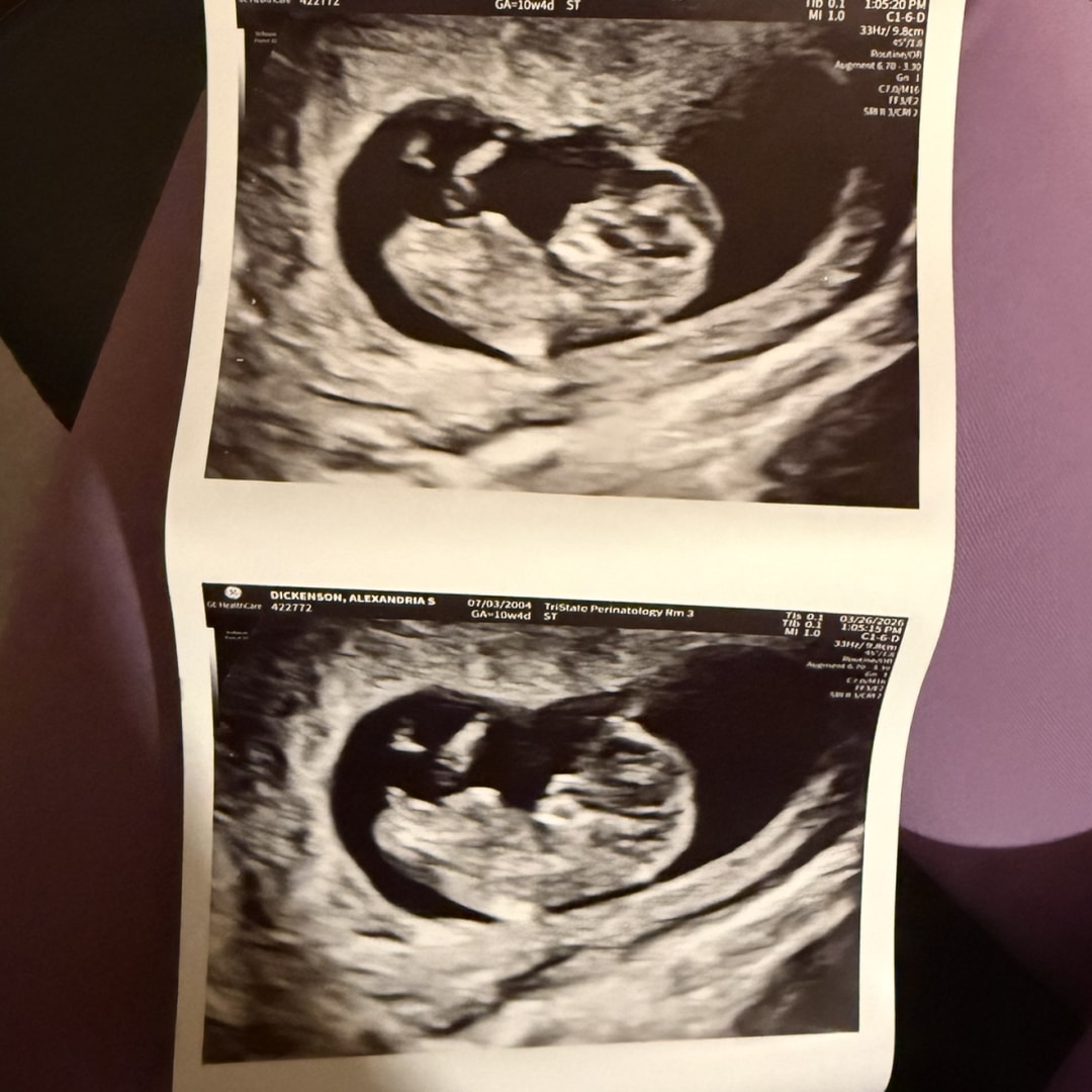 Photo shared by Skye for their Babylist baby registry.