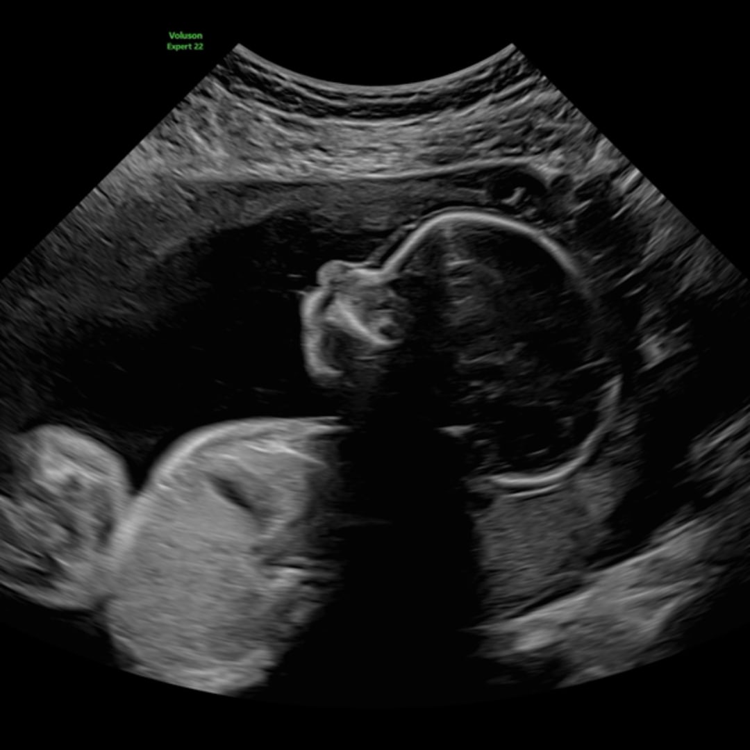 Photo shared by Angela for their Babylist baby registry.