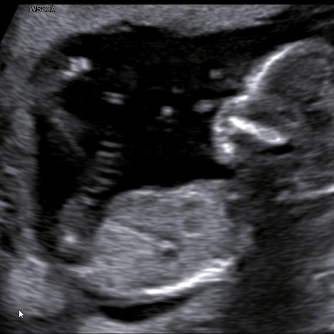 Photo shared by Toka for their Babylist baby registry.