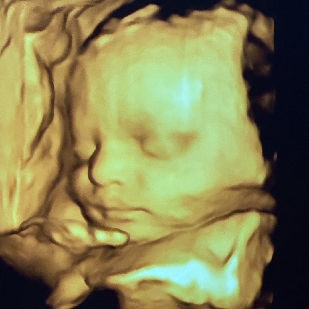 Photo shared by Brittney for their Babylist baby registry.