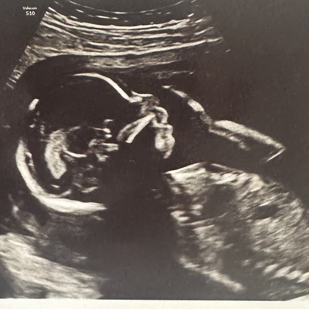 Photo shared by Acacia for their Babylist baby registry.