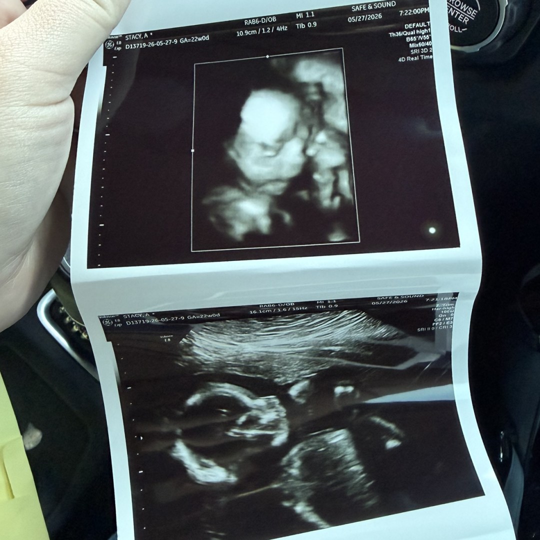 Photo shared by Ashlee for their Babylist baby registry.