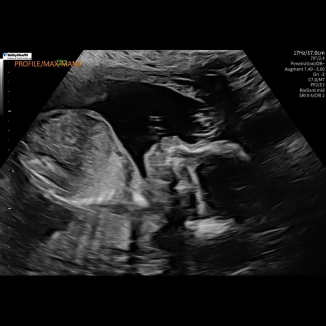 Photo shared by Amelia for their Babylist baby registry.