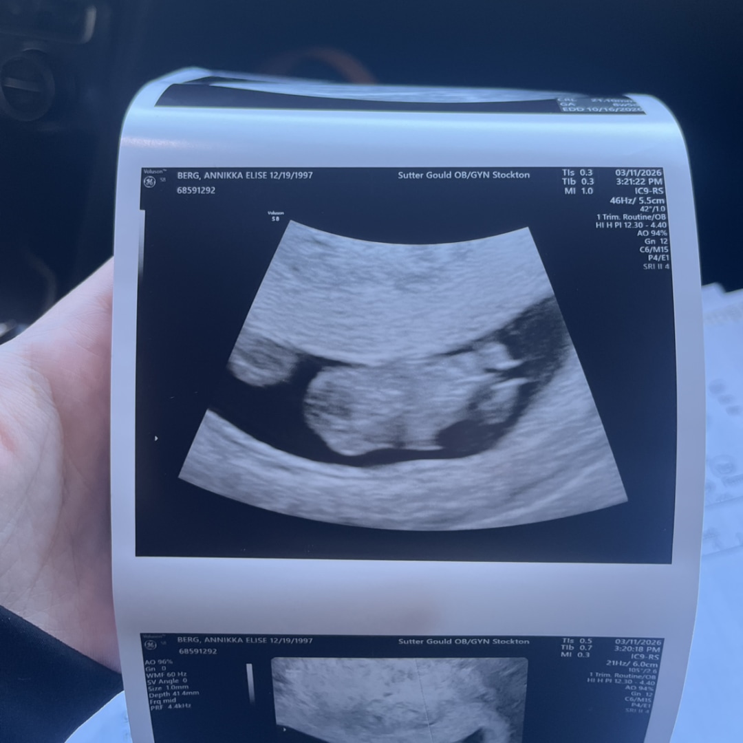 Photo shared by Annikka for their Babylist baby registry.