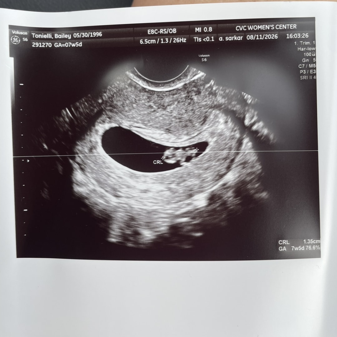 Photo shared by Bailey for their Babylist baby registry.