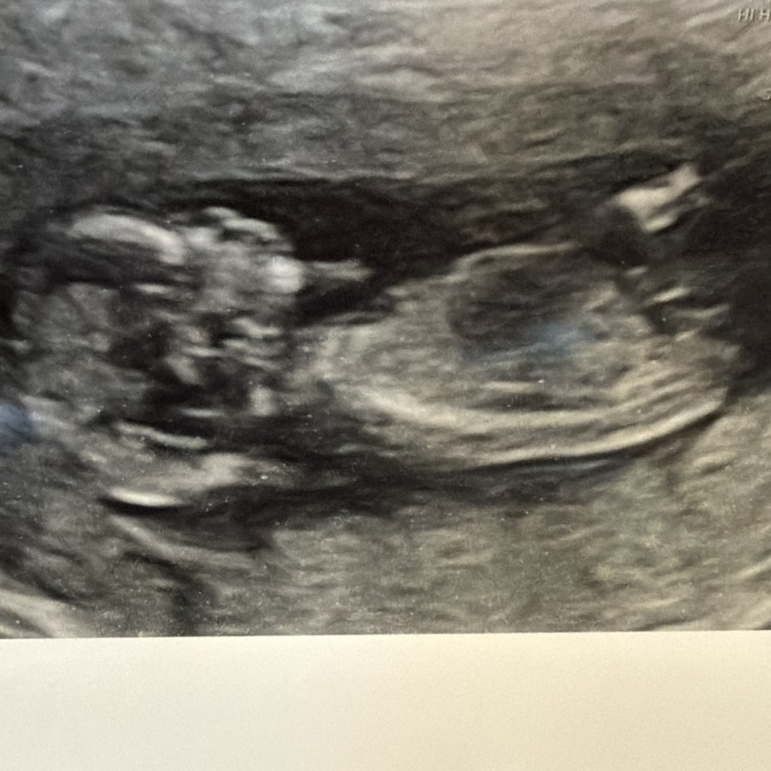 Photo shared by Germayoly for their Babylist baby registry.