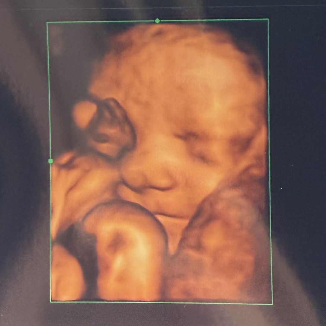 Photo shared by Emma for their Babylist baby registry.