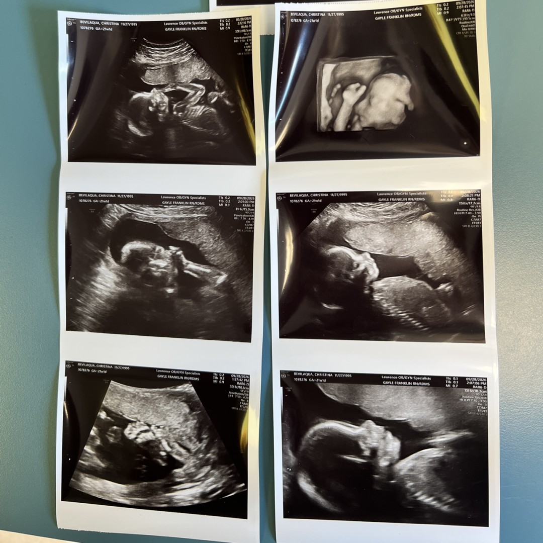 Photo shared by Christina for their Babylist baby registry.
