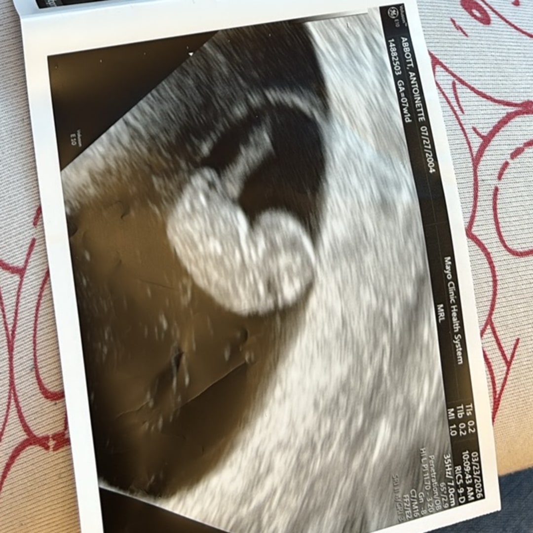 Photo shared by Antoinette for their Babylist baby registry.