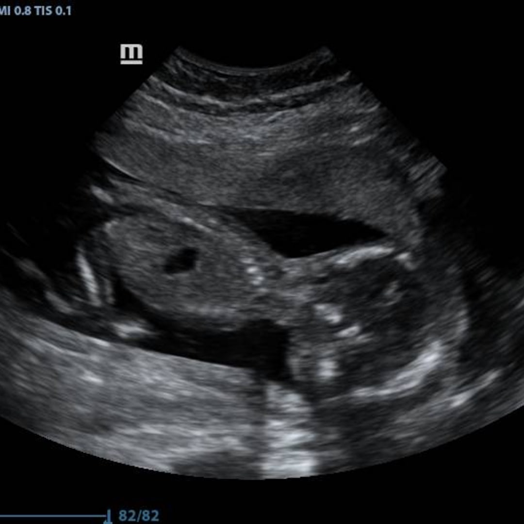 Photo shared by Leigha for their Babylist baby registry.