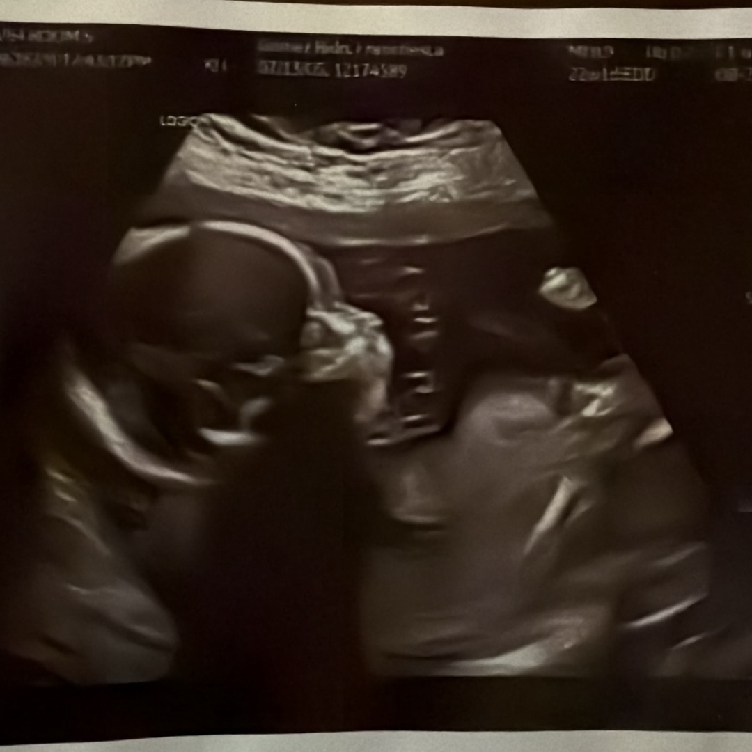 Photo shared by Franchesca for their Babylist baby registry.