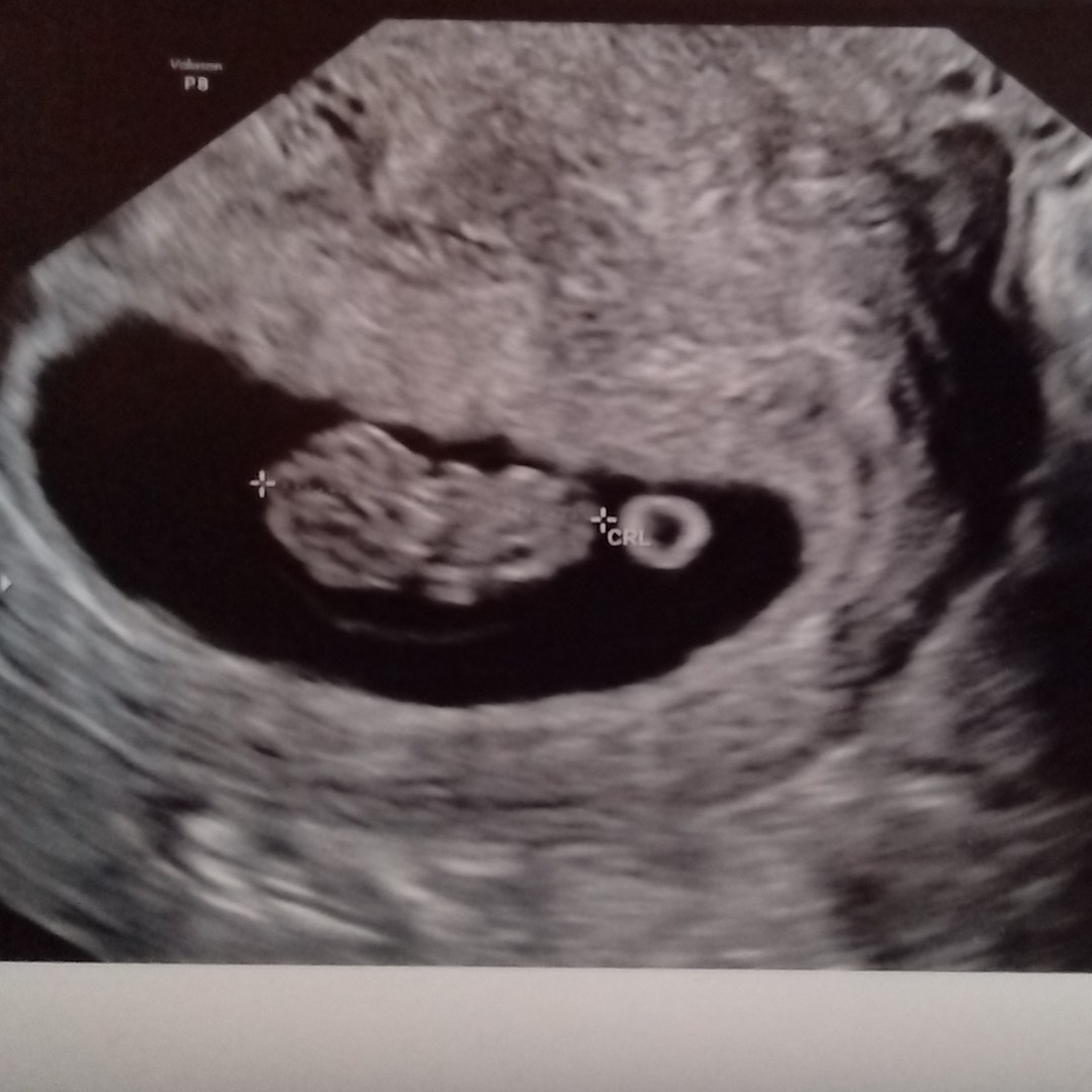 Photo shared by Kelly for their Babylist baby registry.