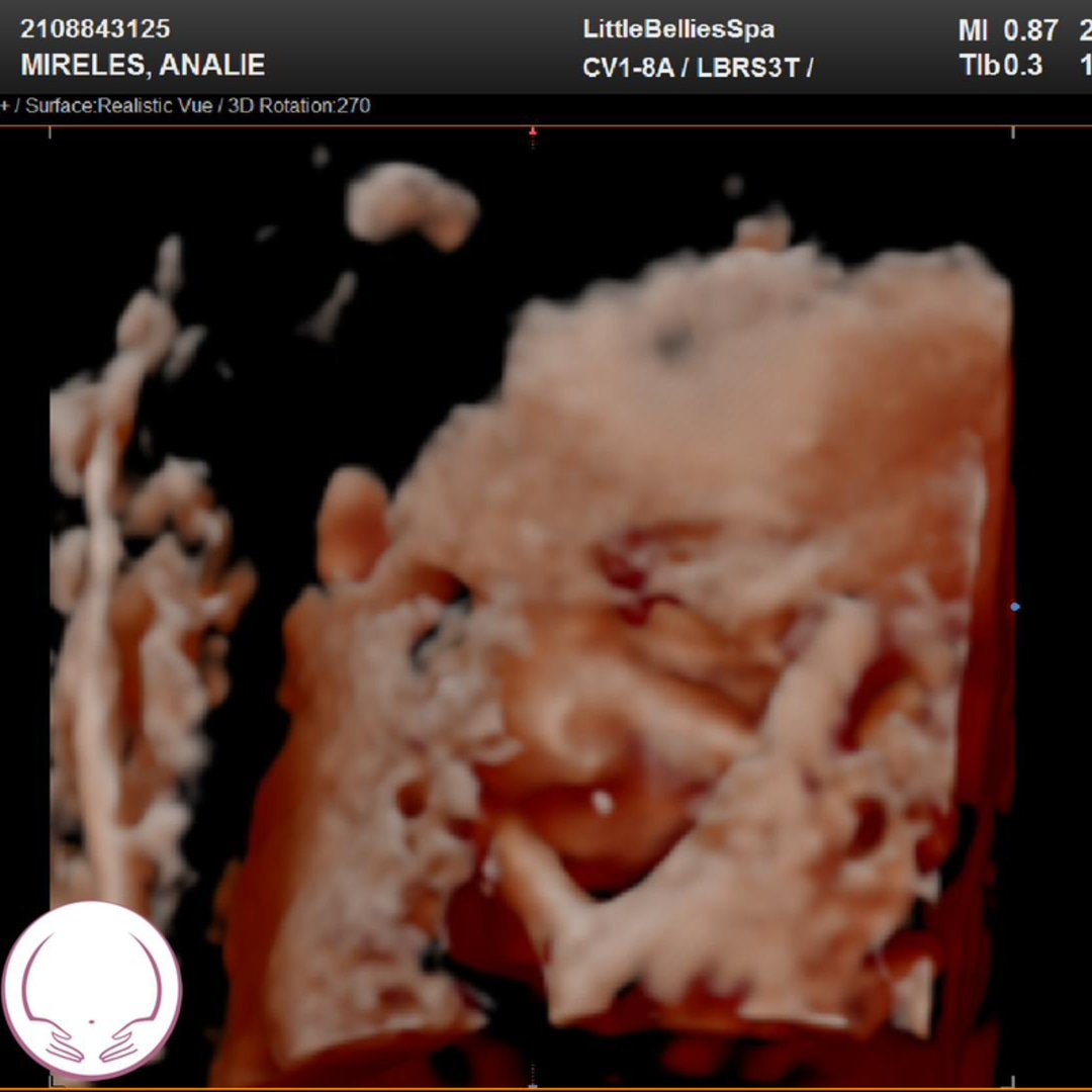 Photo shared by Analie for their Babylist baby registry.