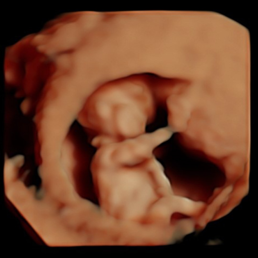 Photo shared by Serena for their Babylist baby registry.