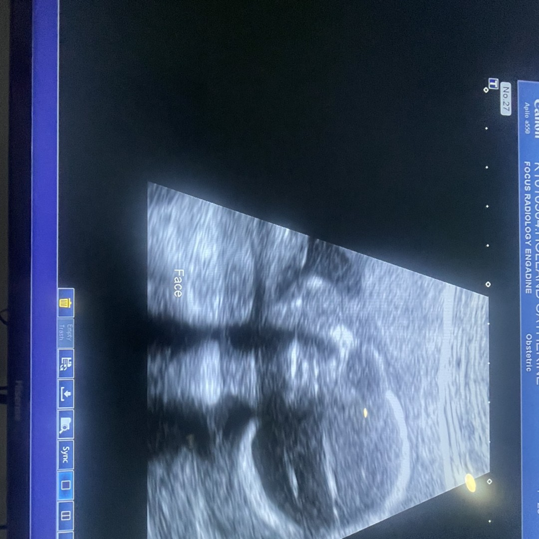 Photo shared by Catherine for their Babylist baby registry.