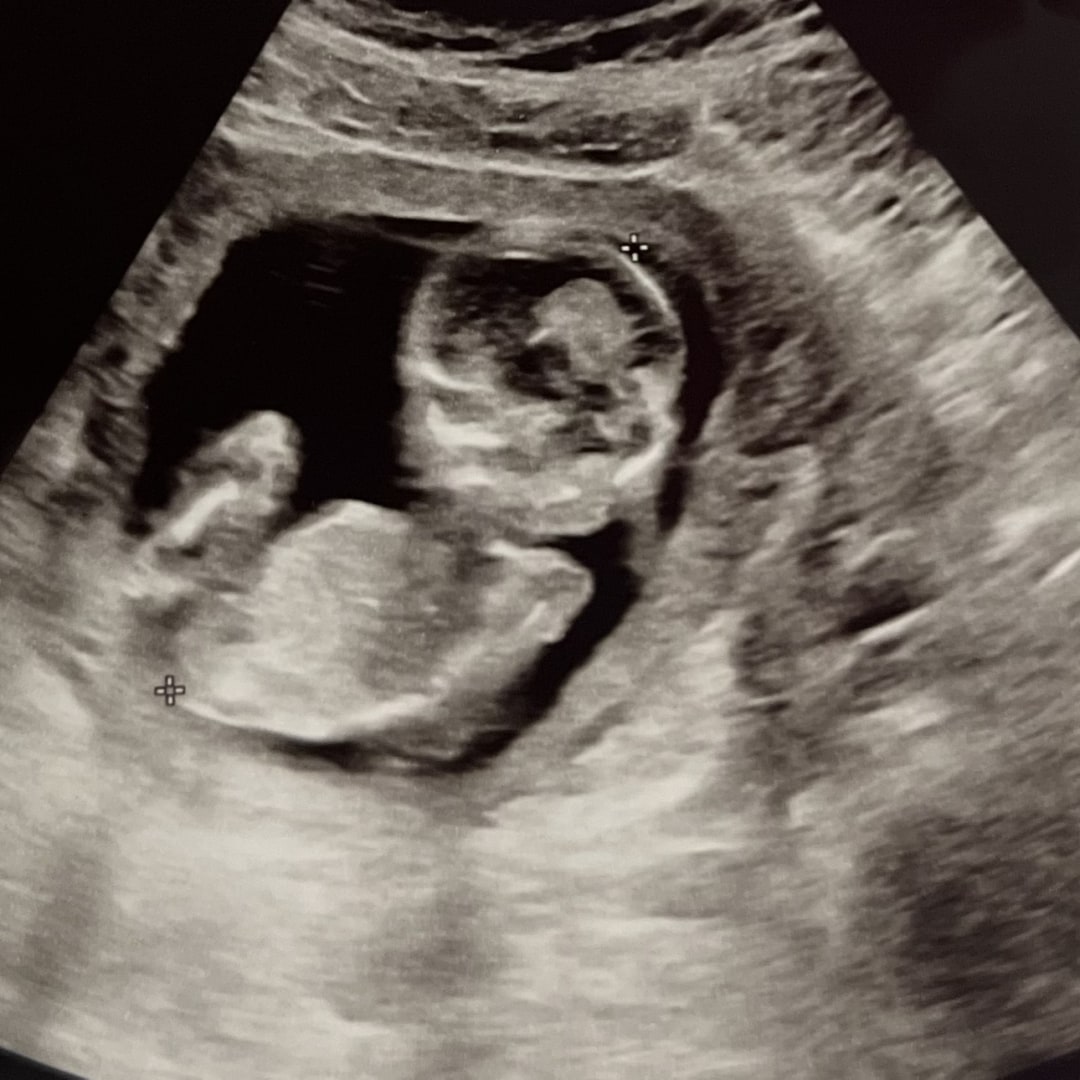 Photo shared by Faith for their Babylist baby registry.