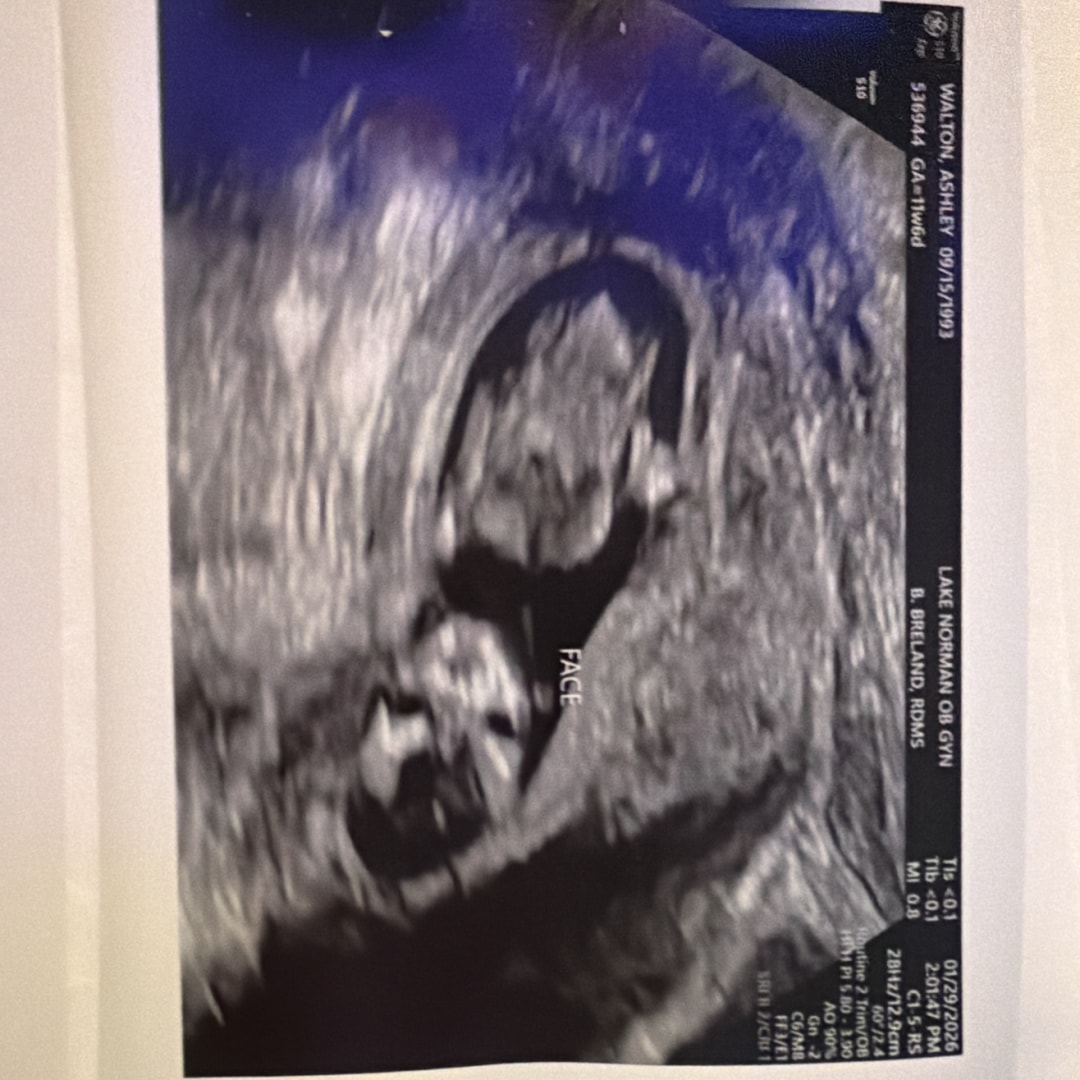 Photo shared by Ashley for their Babylist baby registry.