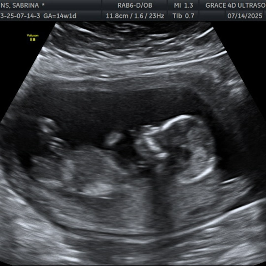 Photo shared by Sabrina for their Babylist baby registry.