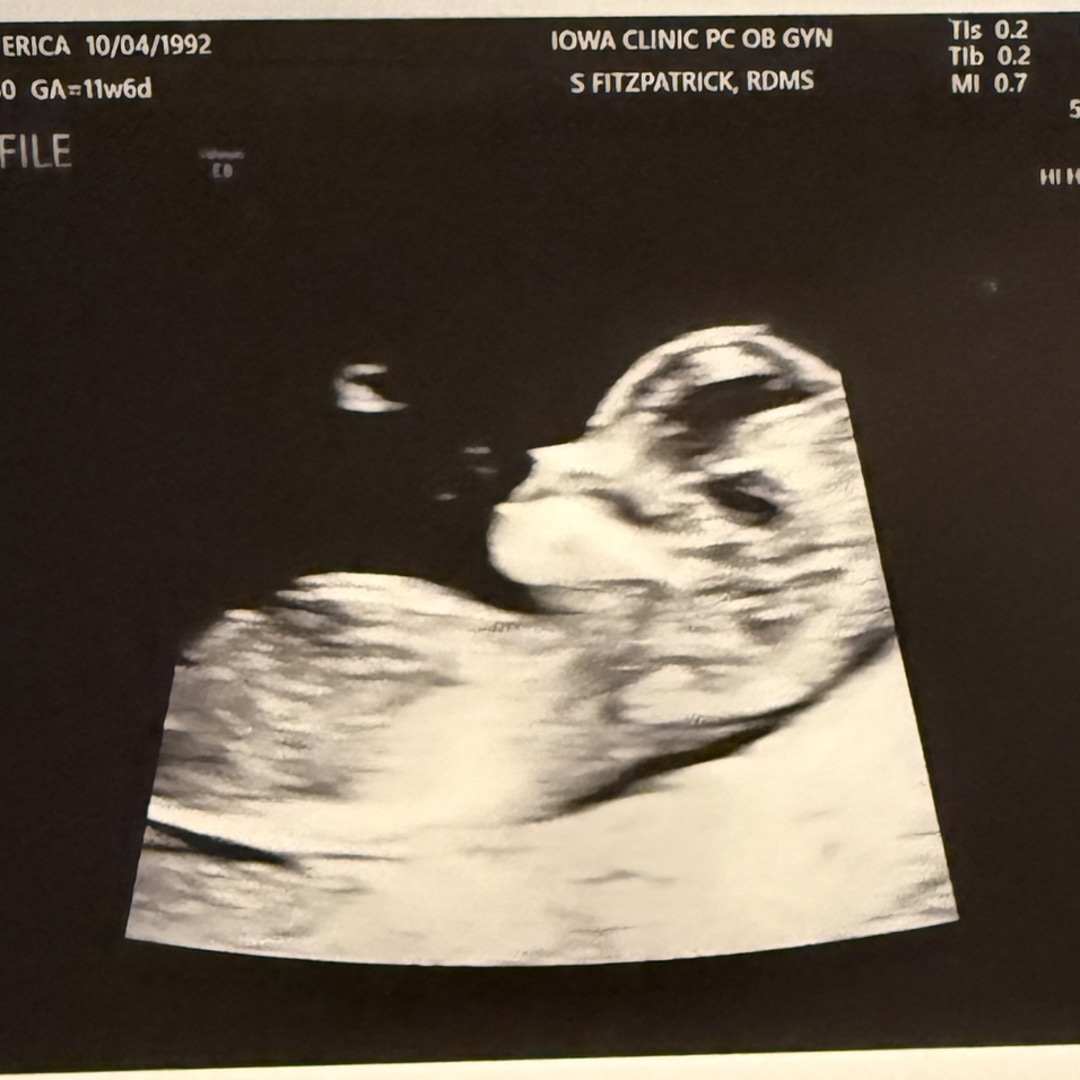 Photo shared by Erica for their Babylist baby registry.