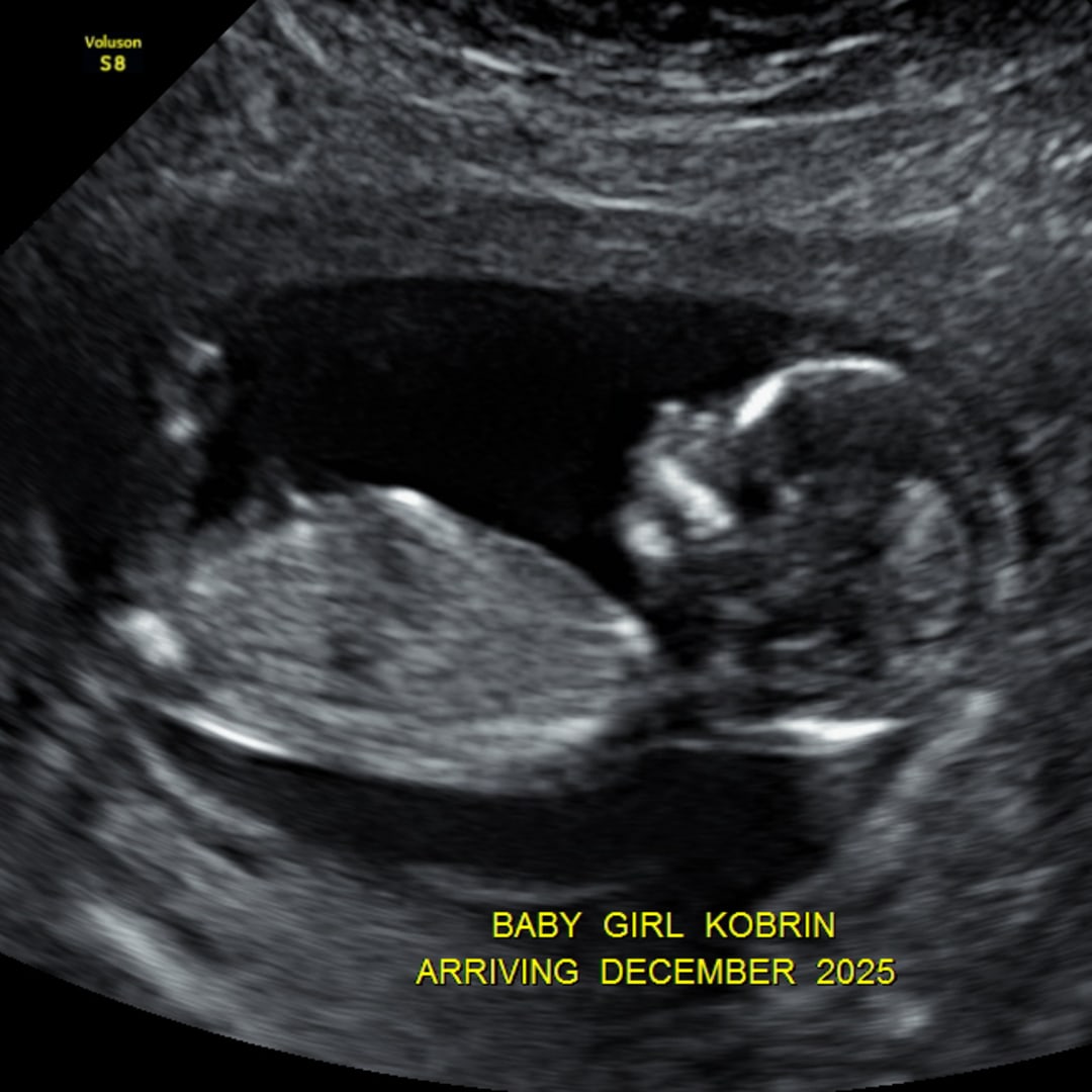 Photo shared by Katelyn for their Babylist baby registry.