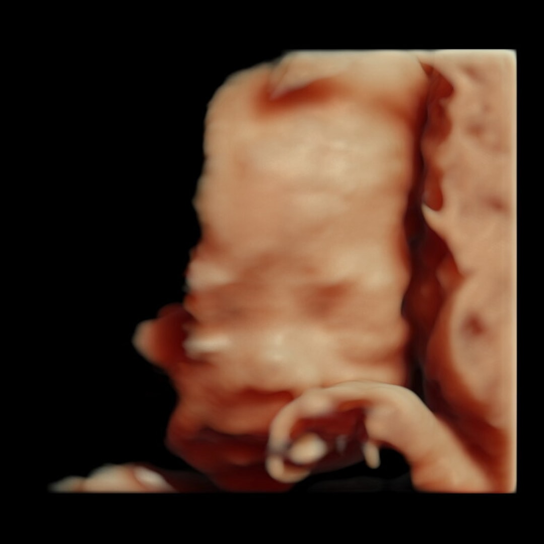 Photo shared by Zoey for their Babylist baby registry.