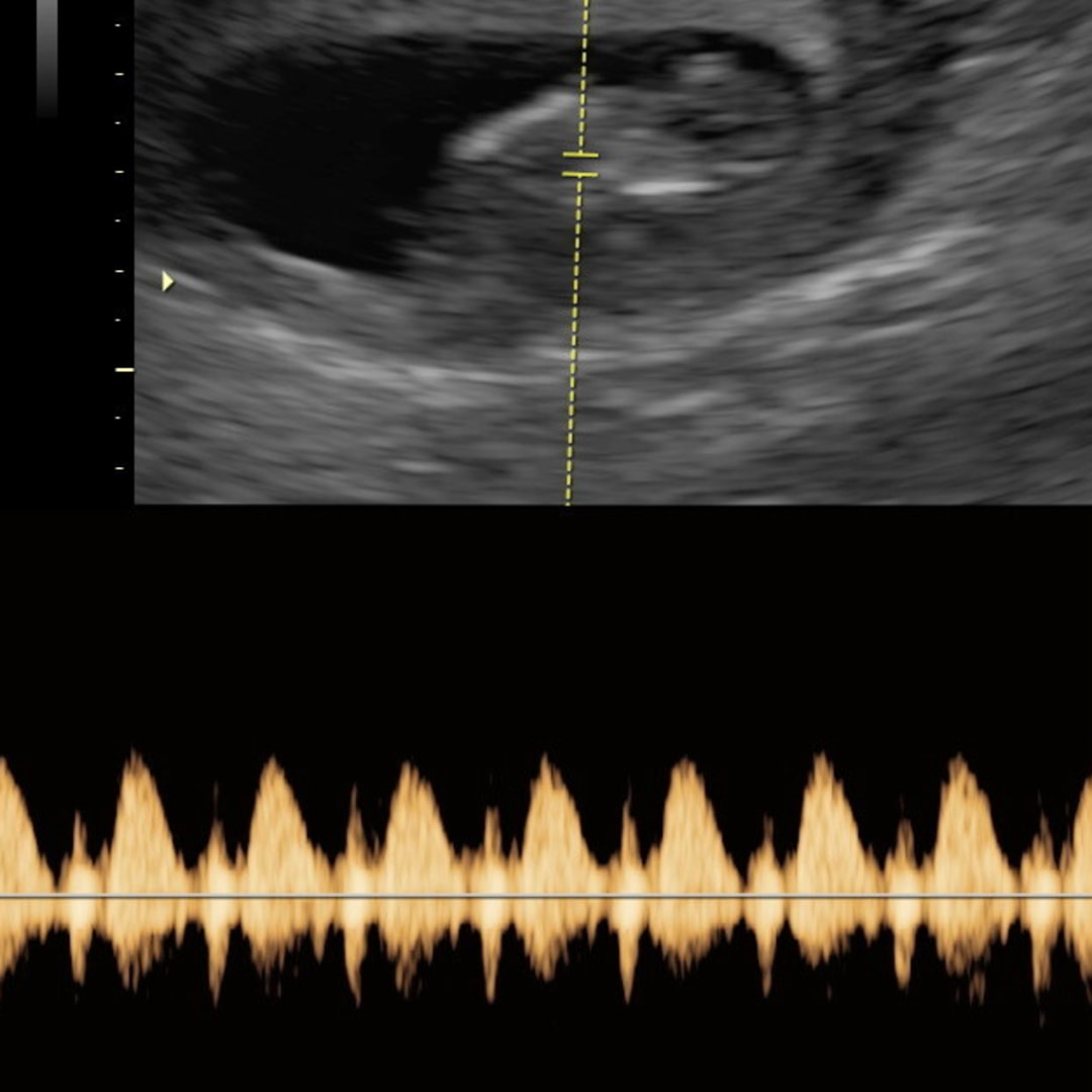 Photo shared by Brianna for their Babylist baby registry.