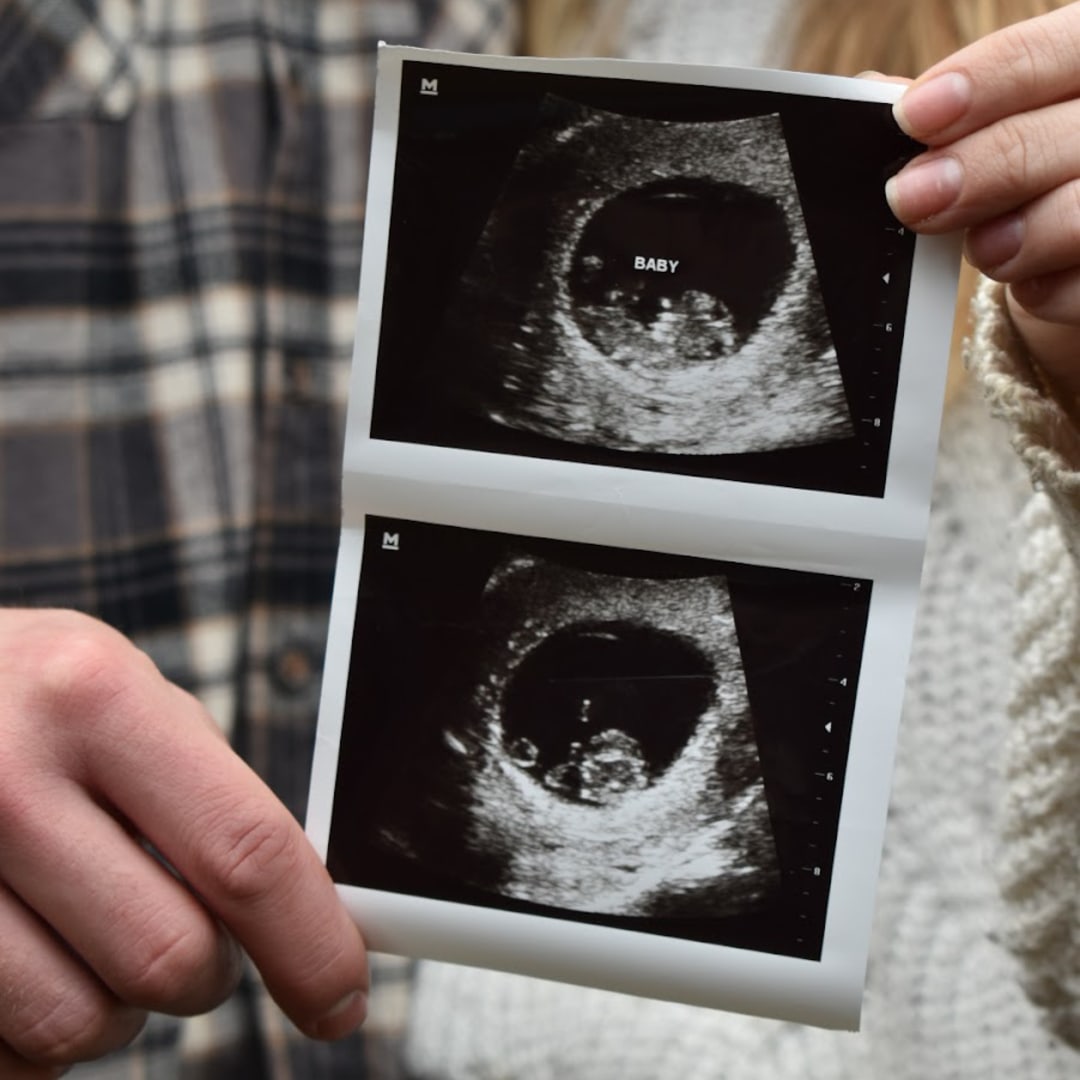 Photo shared by Hailey for their Babylist baby registry.