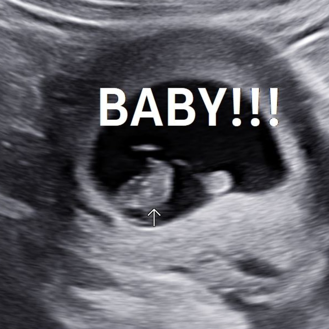 Photo shared by Carli for their Babylist baby registry.