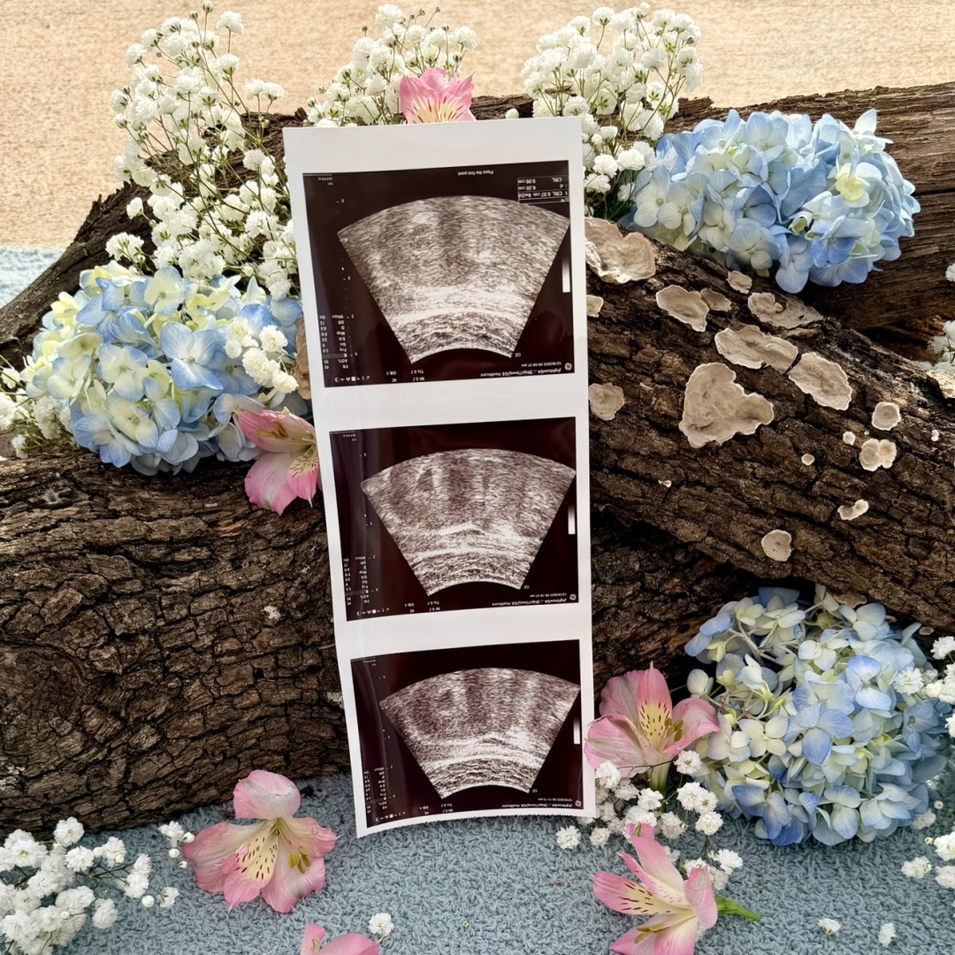 Photo shared by Adrienna for their Babylist baby registry.