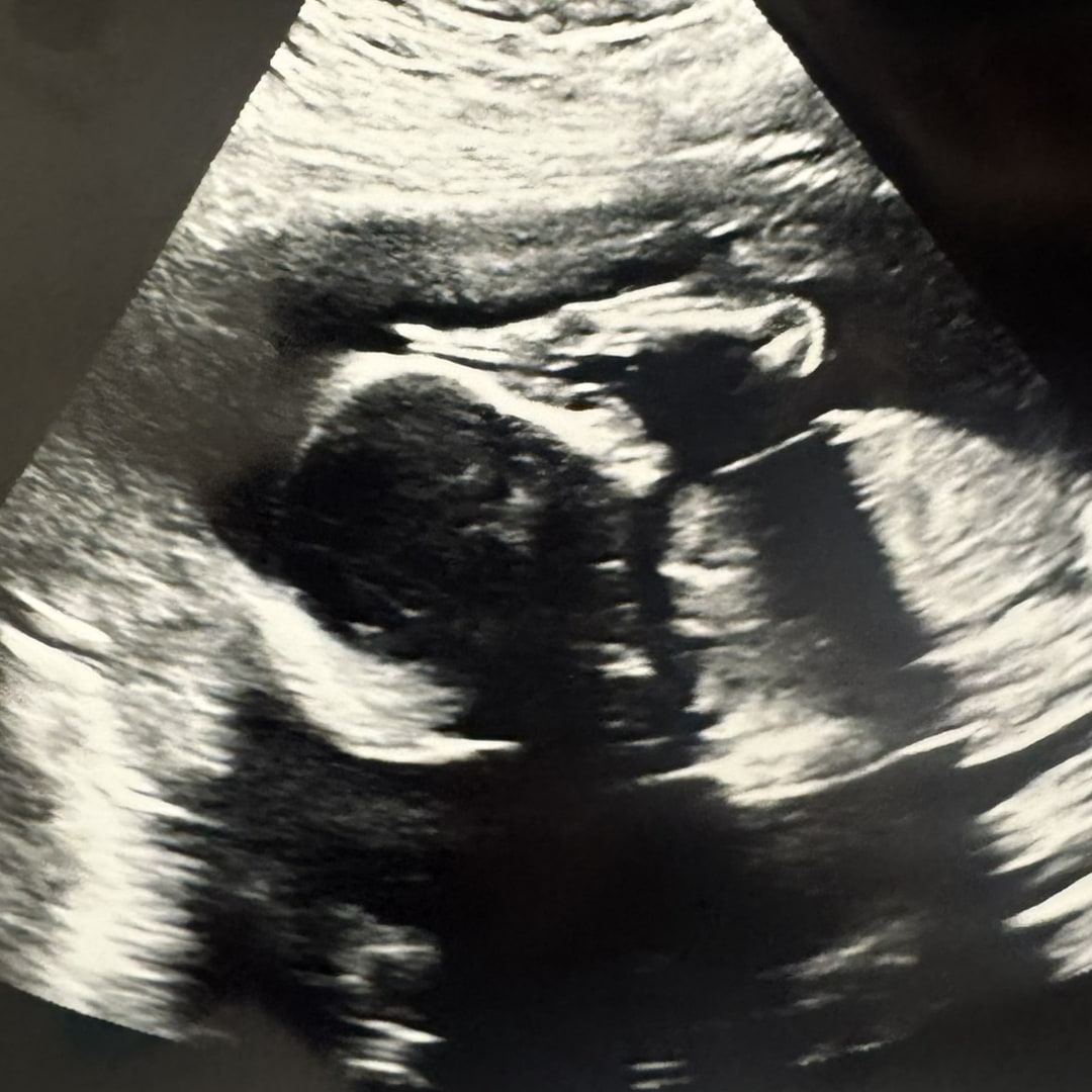 Photo shared by Mariah for their Babylist baby registry.