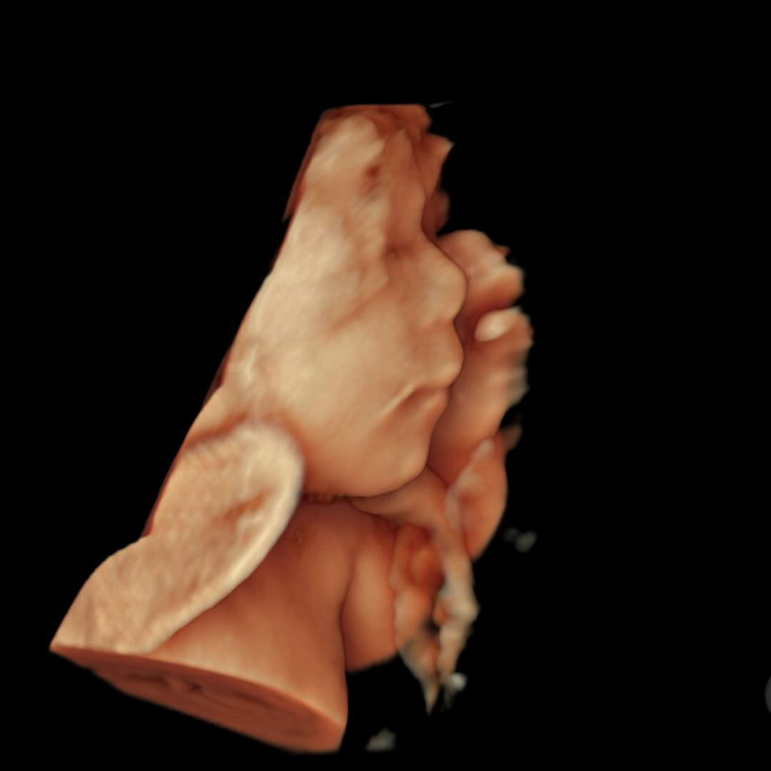 Photo shared by Michelle for their Babylist baby registry.