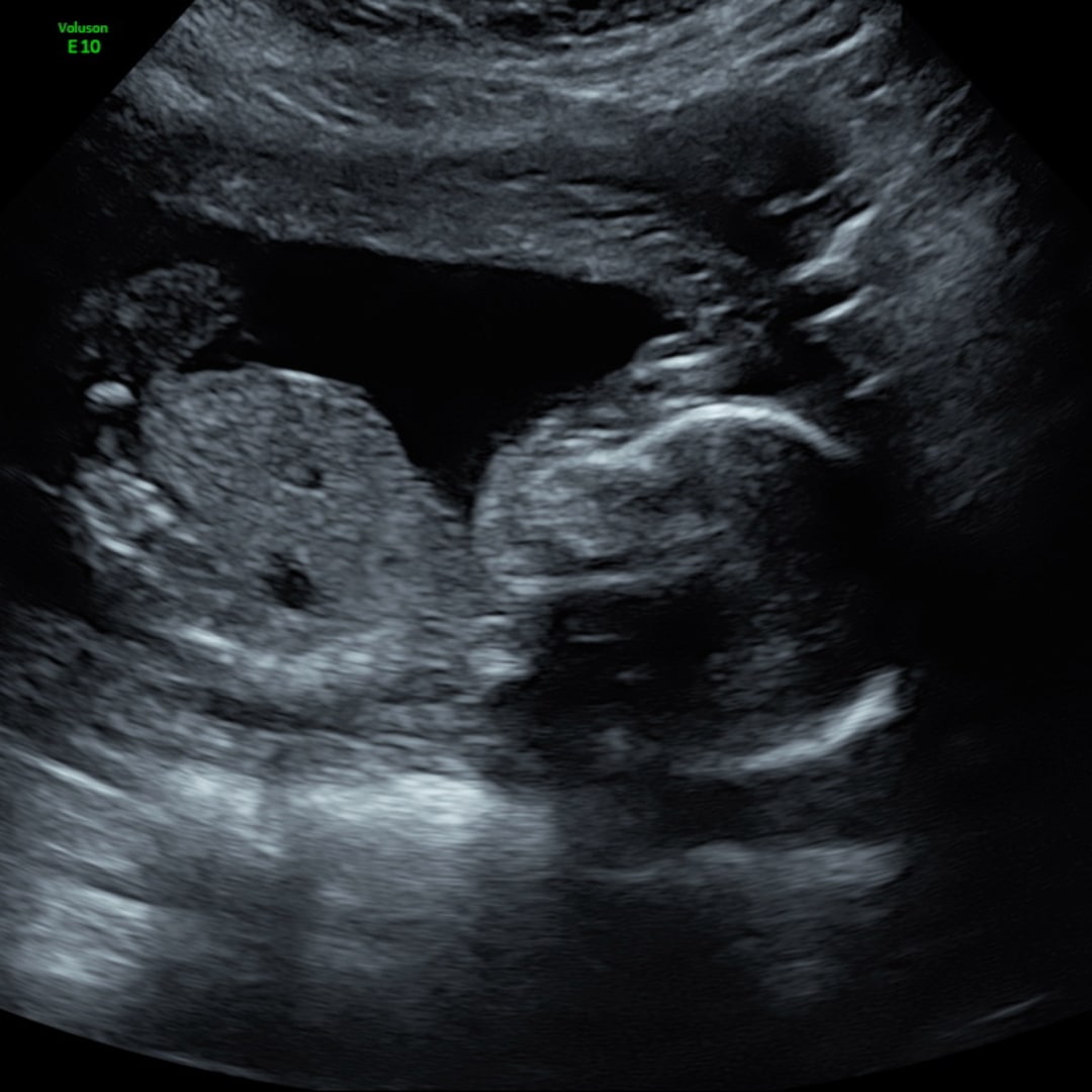 Photo shared by Nikayla for their Babylist baby registry.