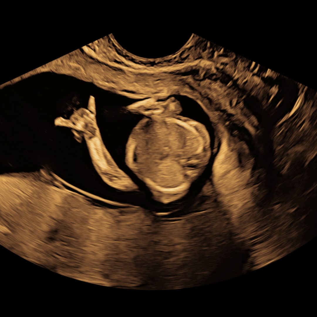 Photo shared by Deb for their Babylist baby registry.