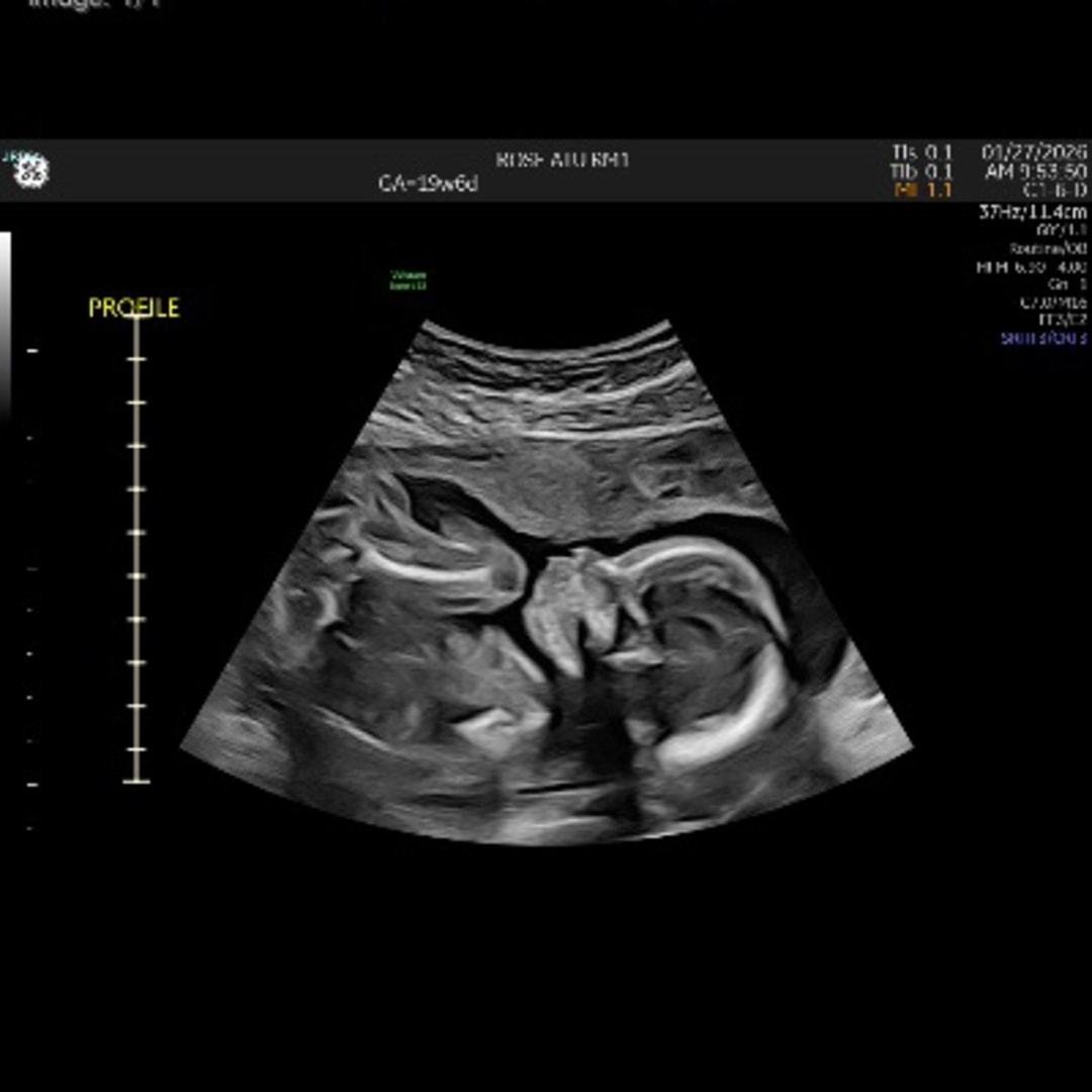 Photo shared by Naomi for their Babylist baby registry.